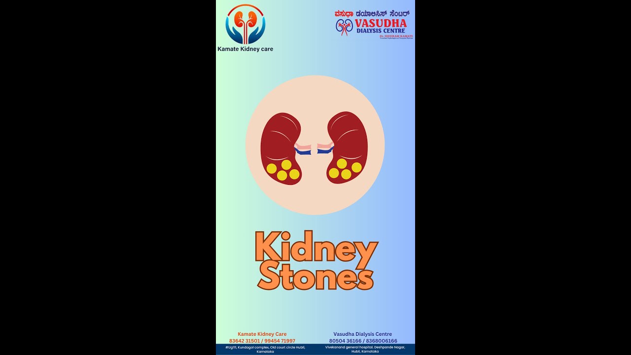 Kidney Stones: diagnosing underlying causes, recommending dietary changes, and preventive measures