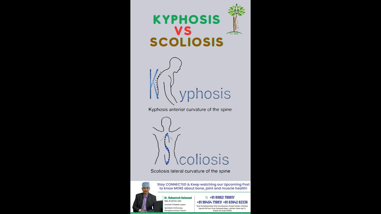 Kyphosis vs scoliosis