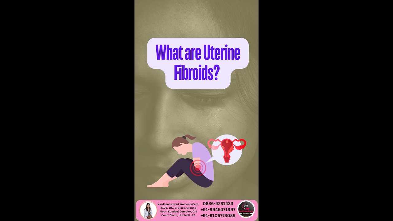 What are Uterine Fibroids? Consult Best Gynecologist in Hubali Dharwad.