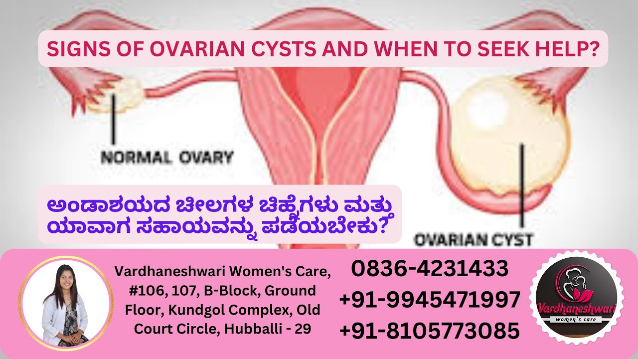 Signs of Ovarian Cysts and When to Seek Help