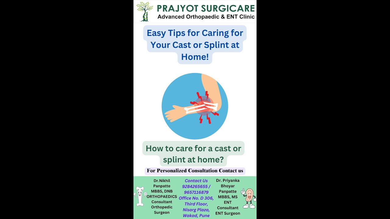 Easy Tips for Caring for Your Cast or Splint at Home! How to care for a cast or splint at home?