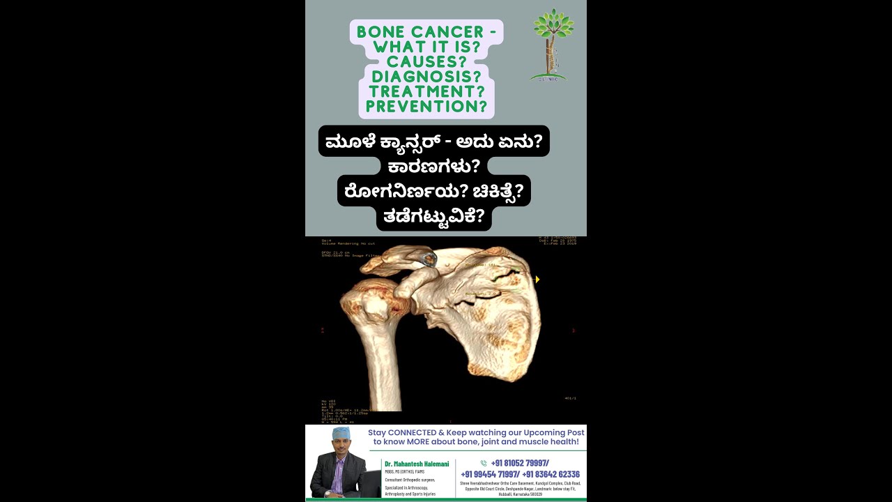 Amazing Insights on Bone Cancer! Bone Cancer – What It is? Causes? Diagnosis? Treatment? Prevention?